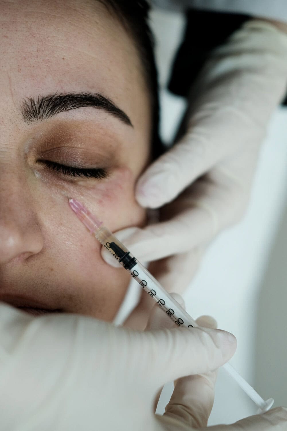 Zeer gespecialiseerde Botox-injectie bij een vrouw met dichtgeknepen ogen.